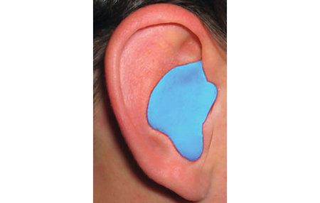 CUSTOM MOLDED EARPLUGS BLUE 1 PAIR